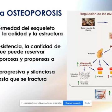 IMELCF y FOSEMO brindan charla sobre salud ósea